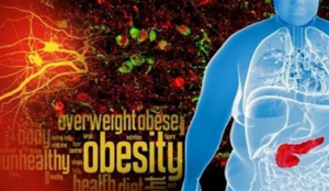 obesity