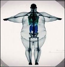 radiografia